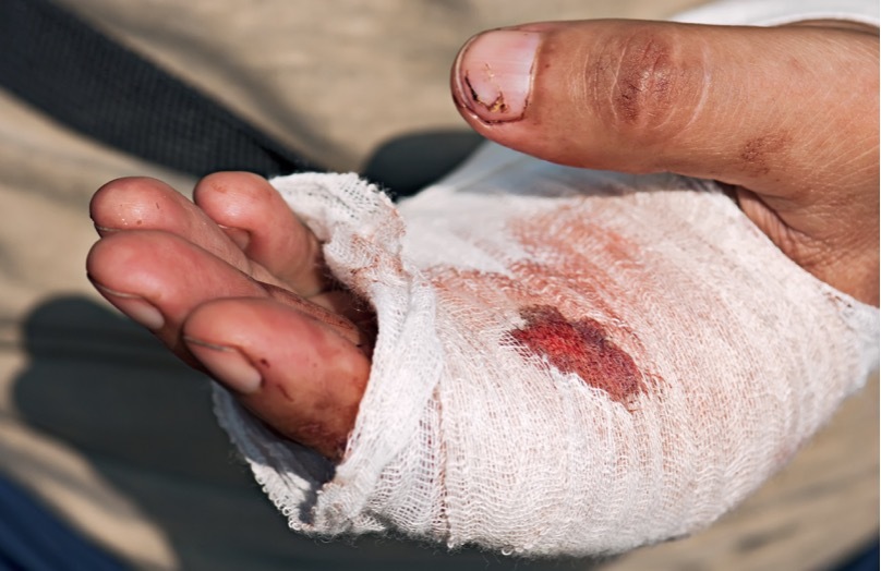 Screen Shot 2019-05-13 at 7.13.32 AM hand injury