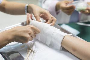 hurt at work workers compensation