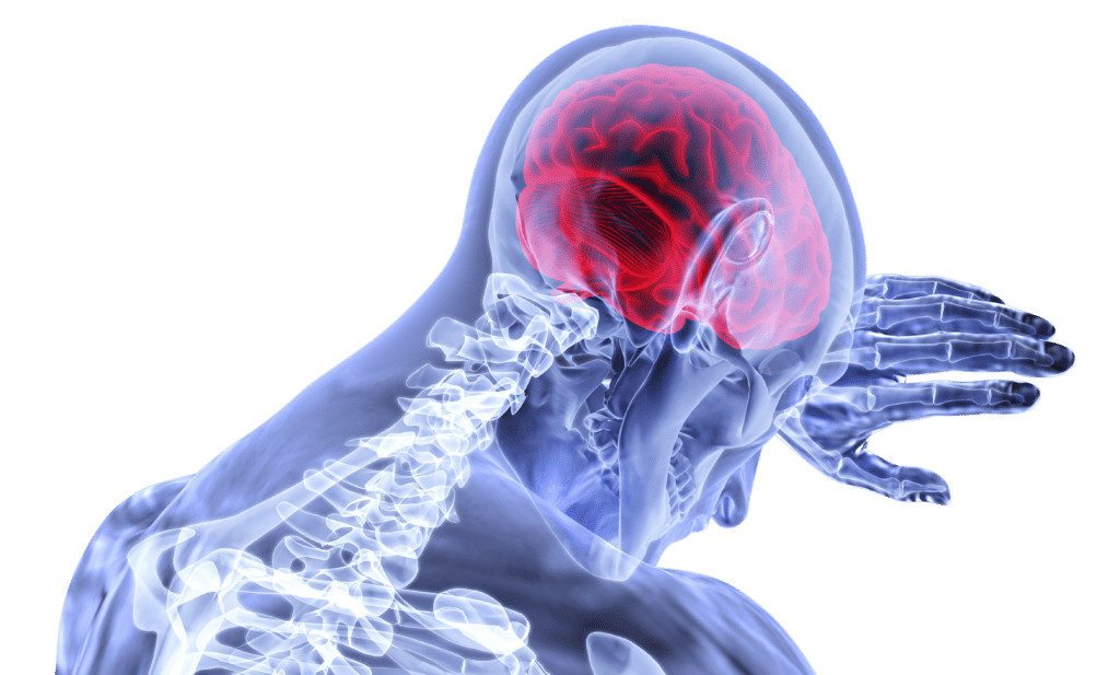 brain-3168269_1920 chicago brain injury attorneys